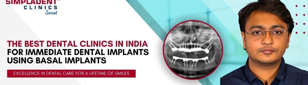 Best Implantologist  Doctors in Surat